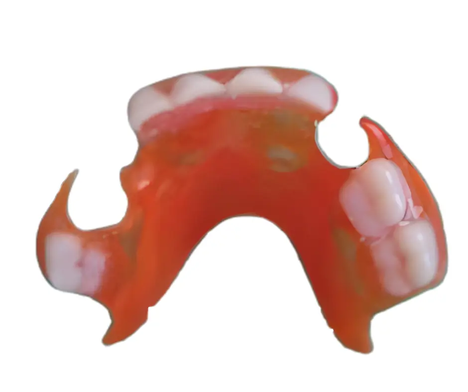 Removable space maintainer for children’s teeth