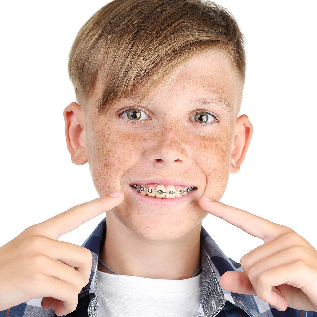 Phase I and Phase II orthodontics explained